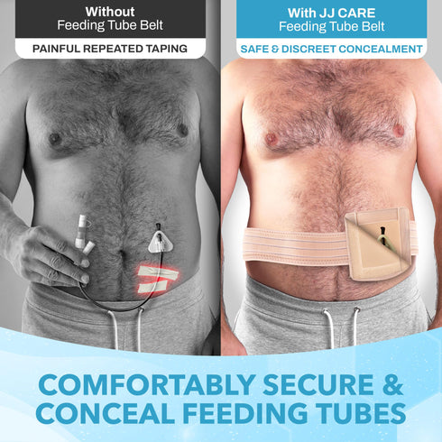 JJ CARE Feeding Tube Belt (Small), Breathable PEG Tube Belt, Nylon Fabric Gtube Belt Compatible with PEG Tubes and Gastrostomy Tubes, Adjustable and Washable G Tube Holder